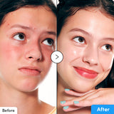 Eqqualberry – Hyaltoin Flooding Serum 30 ml